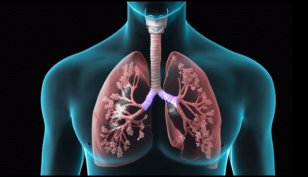Diagnosis and Treatment of COPD Photo